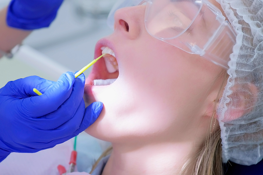 Person at the dentist, getting fluoride applied to their teeth.